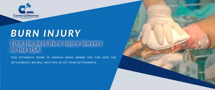 burn injury