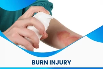 BURN INJURY